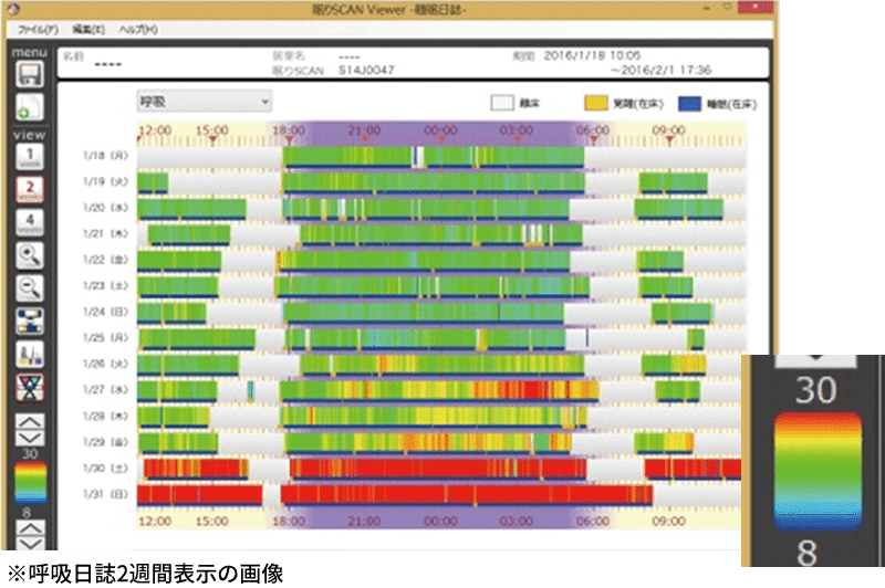 呼吸・心拍日誌